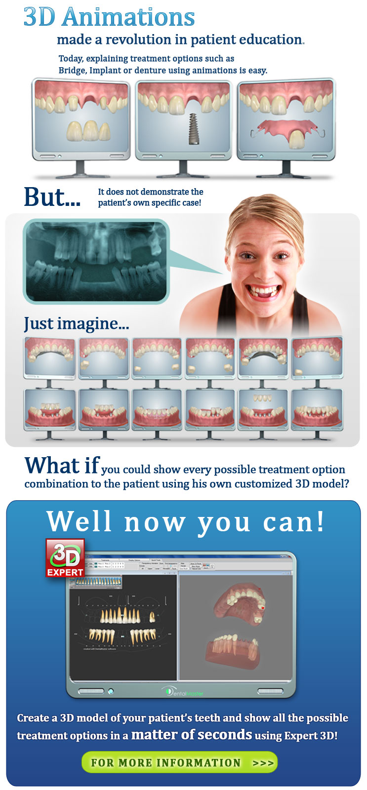 3D dental software
